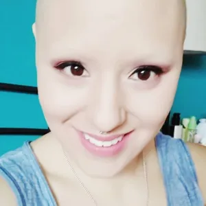 @baldscarmich